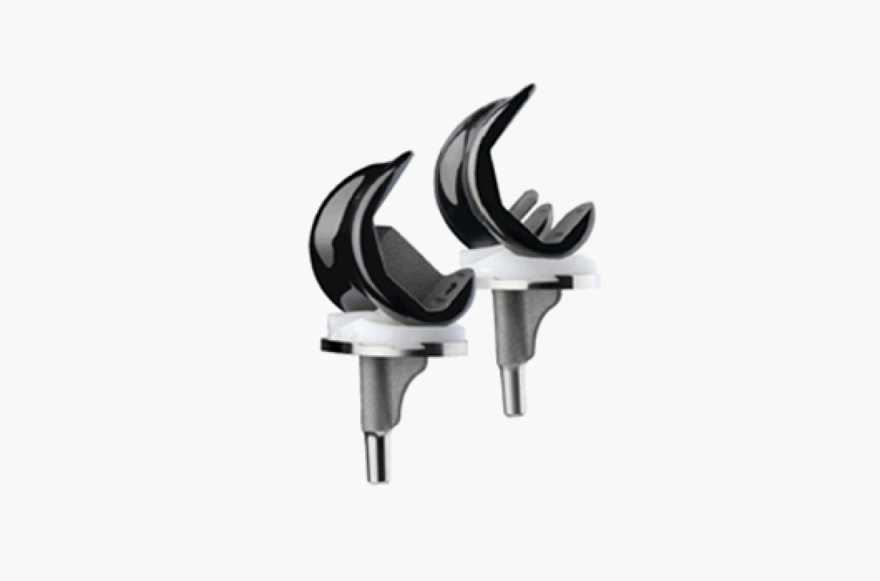 Aufbau einer Knieendoprothese: oben die Femurkomponente, in der Mitte das Knieinlay, unten der Schienbeinkopf (Quelle: Smith & Nephew)  